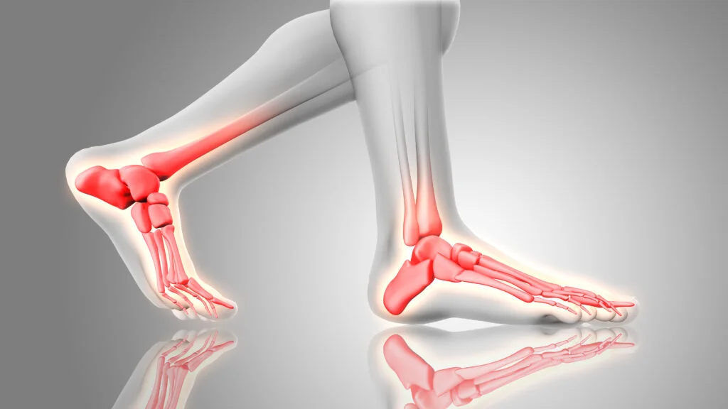 Medical illustration of ankle joint pain