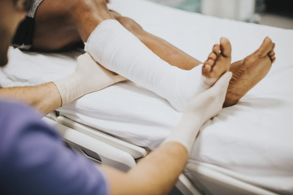 Doctor helping patient with fractured leg